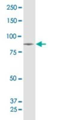 Western Blot: SUV3L1 Antibody [H00006832-B01P] - Analysis of SUPV3L1 expression in PC-12.