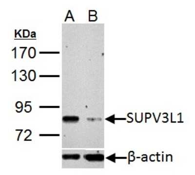 Western Blot: SUV3L1 Antibody [NBP2-20539] - Upper panel: SUPV3L1 antibody [C2C3], C-term Lower panel: beta Actin antibody A. 30 ug HeLa whole cell lysate/extract B. 30 ug whole cell lysate/extract of SUPV3L1 shRNA-tran