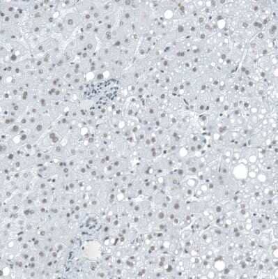 Immunohistochemistry-Paraffin: SUV420H2 Antibody [NBP2-30524] - Staining of human liver shows very weak nuclear positivity in hepatocytes.