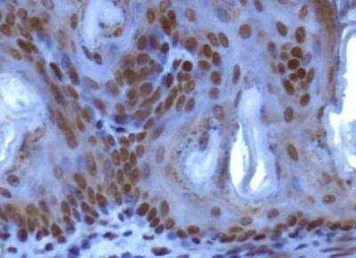 Immunohistochemistry: SUV420h1 Antibody [NBP1-97313] - IHC analysis of SUV420h1 in mouse epidermis using DAB with hematoxylin counterstain.