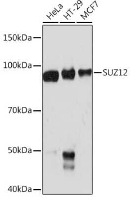 Western Blot: SUZ12 Antibody (1M3V2) [NBP3-16383] - Western blot analysis of extracts of various cell lines, using SUZ12 Rabbit mAb (NBP3-16383) at 1:1000 dilution. Secondary antibody: HRP Goat Anti-Rabbit IgG (H+L) at 1:10000 dilution. Lysates/proteins: 25ug per lane. Blocking buffer: 3% nonfat dry milk in TBST. Detection: ECL Basic Kit. Exposure time: 90s.