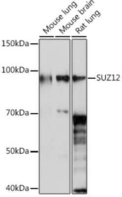 Western Blot: SUZ12 Antibody (1M3V2) [NBP3-16383] - Western blot analysis of extracts of various cell lines, using SUZ12 Rabbit mAb (NBP3-16383) at 1:1000 dilution. Secondary antibody: HRP Goat Anti-Rabbit IgG (H+L) at 1:10000 dilution. Lysates/proteins: 25ug per lane. Blocking buffer: 3% nonfat dry milk in TBST. Detection: ECL Enhanced Kit. Exposure time: 30s.