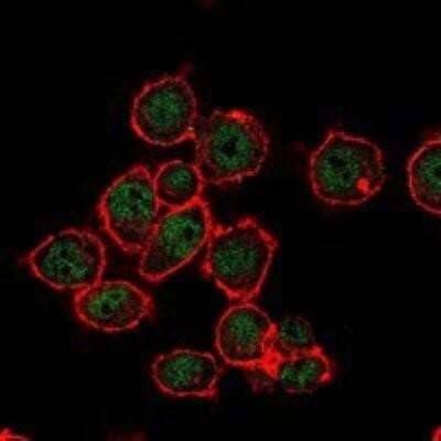 Immunocytochemistry/Immunofluorescence: SUZ12 Antibody (2C11) [NBP1-51686] - Immunofluorescence analysis of MCF-7 cells using SUZ12 mouse mAb (green). Red: Actin filaments have been labeled with Alexa Fluor-555 phalloidin.