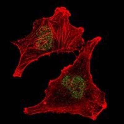 Immunocytochemistry/Immunofluorescence: SUZ12 Antibody (2C11) [NBP1-51686] - Immunofluorescence analysis of U251 cells using SUZ12 mouse mAb (green). Red: Actin filaments have been labeled with Alexa Fluor-555 phalloidin.