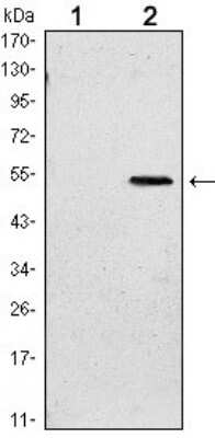 Western Blot: SUZ12 Antibody (3D10) [NBP1-51687] - Western blot analysis using SUZ12 mAb against HEK293 (1) and SUZ12-hIgGFc transfected HEK293 (2) cell lysate.
