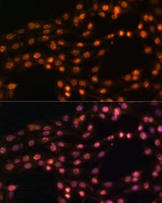 Immunocytochemistry/Immunofluorescence: SUZ12 Antibody [NBP3-03738] - Analysis of C6 cells using SUZ12 antibody at dilution of 1:100 (40x lens). Blue: DAPI for nuclear staining.