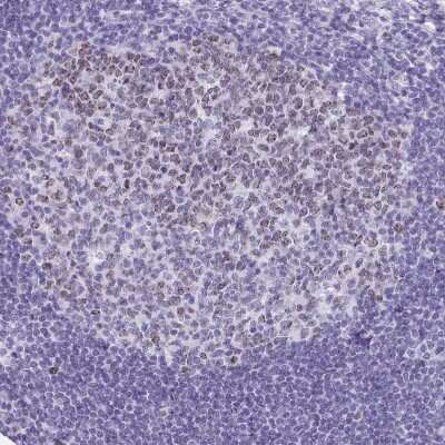 Immunohistochemistry-Paraffin: SUZ12 Antibody [NBP2-33834] - Staining of human tonsil shows weak nuclear positivity in germinal center cells.