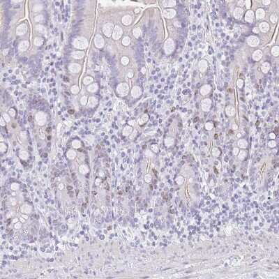 Immunohistochemistry-Paraffin: SUZ12 Antibody [NBP2-33834] - Staining of human small intestine shows weak nuclear positivity in glandular cells.