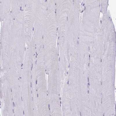 Immunohistochemistry-Paraffin: SUZ12 Antibody [NBP2-33834] - Staining of human skeletal muscle shows no positivity in myocytes as expected.