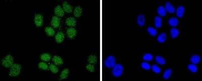 Immunocytochemistry/Immunofluorescence: SUZ12 Antibody (JJ09-04) [NBP2-67888] - Staining SUZ12 in MCF-7 cells (green). The nuclear counter stain is DAPI (blue). Cells were fixed in paraformaldehyde, permeabilised with 0.25% Triton X100/PBS.