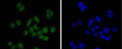 Immunocytochemistry/Immunofluorescence: SUZ12 Antibody (JJ09-04) [NBP2-67888] - Staining SUZ12 in SW480 cells (green). The nuclear counter stain is DAPI (blue). Cells were fixed in paraformaldehyde, permeabilised with 0.25% Triton X100/PBS.