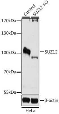 <b>Genetic Strategies Validation. </b>Knockout Validated: SUZ12 Antibody [NBP3-03738] - Analysis of extracts from normal (control) and SUZ12 knockout (KO) HeLa cells, using SUZ12 antibody at 1:1000 dilution. Secondary antibody: HRP Goat Anti-Rabbit IgG (H+L) at 1:10000 dilution. Lysates/proteins: 25ug per lane. Blocking buffer: 3% nonfat dry milk in TBST.