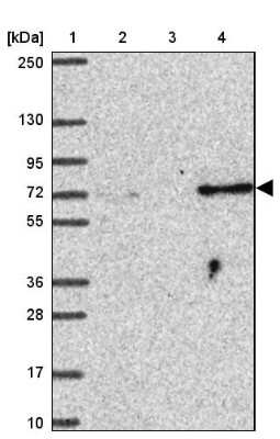 Western Blot SUZ12 Antibody