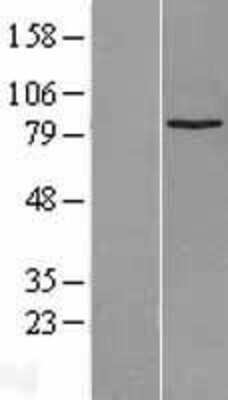 Western Blot SUZ12 Overexpression Lysate