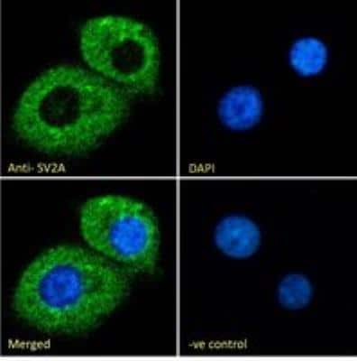 Immunocytochemistry/Immunofluorescence: SV2A Antibody [NB100-41402] - Immunofluorescence analysis of paraformaldehyde fixed KNRK cells, permeabilized with 0.15% Triton. Primary incubation 1hr (10ug/ml) followed by Alexa Fluor 488 secondary antibody (2ug/ml), showing cytoplasmic staining. The nuclear stain is DAPI (blue). Negative control: Unimmunized goat IgG (10ug/ml) followed by Alexa Fluor 488 secondary antibody (2ug/ml).