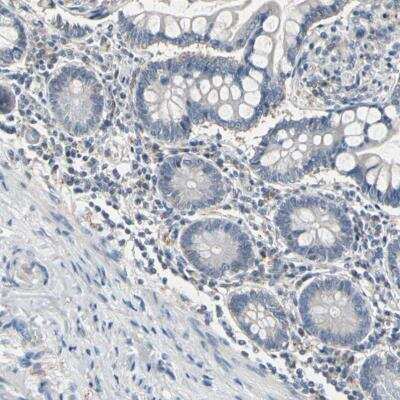 Immunohistochemistry-Paraffin: SV2A Antibody [NBP1-82964] - Staining of human small intestine shows no positivity in glandular cells.