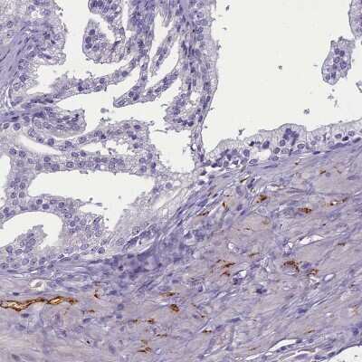 Immunohistochemistry-Paraffin: SV2C Antibody [NBP1-86239] - Staining of human prostate shows moderate cytoplasmic positivity in peripheral nerve.