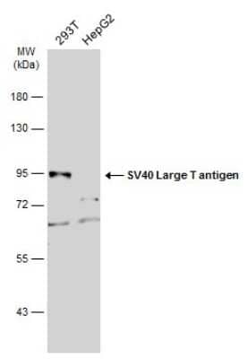 Western Blot: SV40 T-antigen Antibody [NBP3-13382] - Various whole cell extracts (30 ug) were separated by 7.5% SDS-PAGE, and the membrane was blotted with SV40 Large T antigen antibody (NBP3-13382) diluted at 1:1000. The HRP-conjugated anti-rabbit IgG antibody (NBP2-19301) was used to detect the primary antibody.