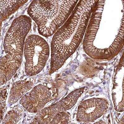 Immunohistochemistry-Paraffin SVIP Antibody