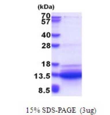 SDS-Page: SVIP Recombinant Protein [NBP2-51646] - 15% SDS Page (3 ug)