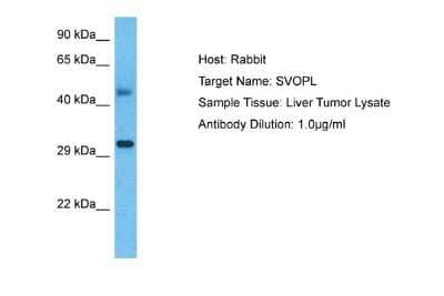 Western Blot: SVOPL Antibody [NBP2-83608] - Host: Rabbit. Target Name: SVOPL. Sample Type: Liver Tumor lysates. Antibody Dilution: 1.0ug/ml