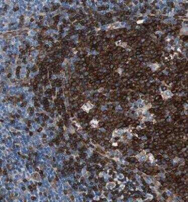 Immunohistochemistry-Paraffin: SWAP70 Antibody [NBP1-82979] - Staining of human lymph node shows strong cytoplasmic positivity in germinal center cells.