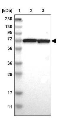 Western Blot: SWAP70 Antibody [NBP1-82979] - Lane 1: Marker  [kDa] 230, 130, 95, 72, 56, 36, 28, 17, 11.  Lane 2: Human cell line RT-4.  Lane 3: Human cell line U-251MG sp