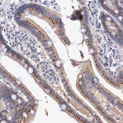 Immunohistochemistry-Paraffin: SYAP1 Antibody [NBP1-82230] - Staining of human duodenum shows strong granular cytoplasmic positivity in glandular cells.