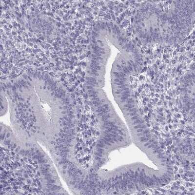 Immunohistochemistry-Paraffin SYCE1 Antibody - BSA Free
