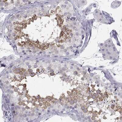 Immunohistochemistry-Paraffin SYCE1 Antibody - BSA Free