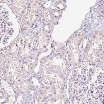 Immunohistochemistry-Paraffin SYCE2 Antibody - BSA Free