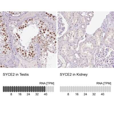 Immunohistochemistry-Paraffin SYCE2 Antibody - BSA Free