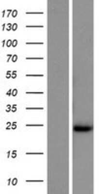 Western Blot SYCE2 Overexpression Lysate