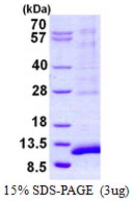SDS-Page: SYCE3 Protein [NBP2-22836]