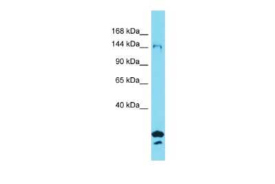 Western Blot: SYDE2 Antibody [NBP2-85852] - Host: Rabbit. Target Name: SYDE2. Sample Type: OVCAR-3 Whole Cell lysates. Antibody Dilution: 1.0ug/ml