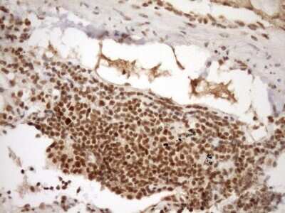 Immunohistochemistry SYF2 Antibody (OTI6A5)