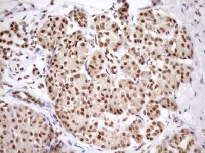 Immunohistochemistry SYF2 Antibody (OTI6A5)