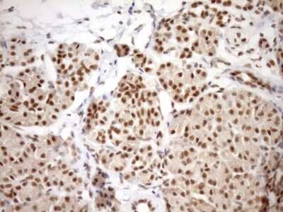 Immunohistochemistry: SYF2 Antibody (6A5) [NBP2-46033] - Analysis of Human thyroid tissue. (Heat-induced epitope retrieval by Tris-EDTA, pH8.0)