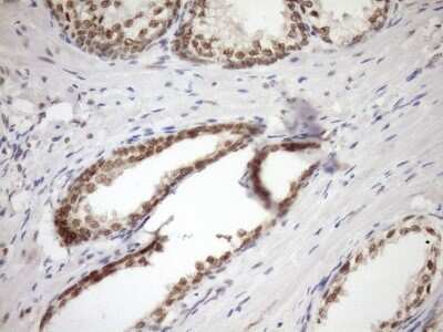Immunohistochemistry: SYF2 Antibody (6A5) [NBP2-46033] - Analysis of Human prostate tissue. (Heat-induced epitope retrieval by Tris-EDTA, pH8.0)