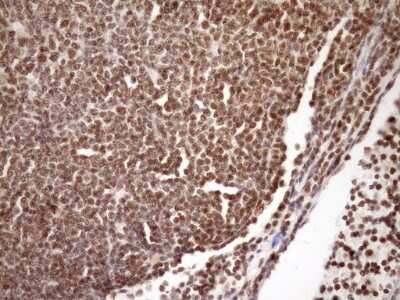 Immunohistochemistry: SYF2 Antibody (6A5) [NBP2-46033] - Analysis of Human lymphoma tissue. (Heat-induced epitope retrieval by Tris-EDTA, pH8.0)