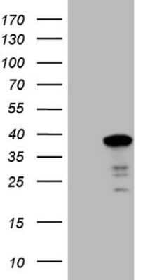 Western Blot: SYF2 Antibody (OTI6A5) - Azide and BSA Free [NBP2-74413] - Analysis of HEK293T cells were transfected with the pCMV6-ENTRY control (Left lane) or pCMV6-ENTRY SYF2.