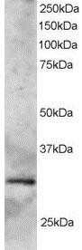 Western Blot SYF2 Antibody