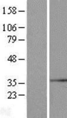 Western Blot: SYF2 Overexpression Lysate (Adult Normal) [NBL1-16636] Left-Empty vector transfected control cell lysate (HEK293 cell lysate); Right -Over-expression Lysate for SYF2.