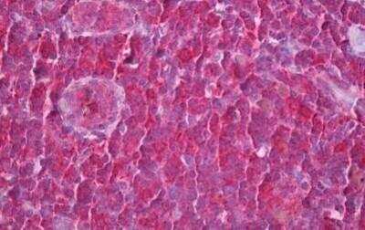 Immunohistochemistry-Paraffin: SYK Antibody (8H5) [NBP2-11524] - Analysis of anti-SYK antibody with human tonsil at dilution 1:400.