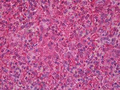 Immunohistochemistry-Paraffin: SYK Antibody (8H5) [NBP2-11524] - Analysis of anti-SYK antibody with human spleen at dilution 1:400.