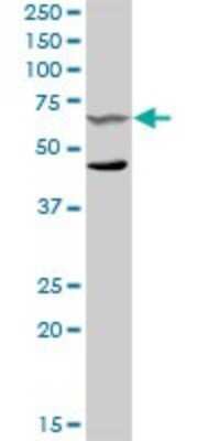 Western Blot: SYK Antibody [H00006850-D01P] - Analysis of SYK expression in HeLa.