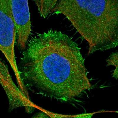 Immunocytochemistry/Immunofluorescence: SYNC Antibody [NBP2-14497] - Immunofluorescent staining of human cell line U-2 OS shows localization to plasma membrane.