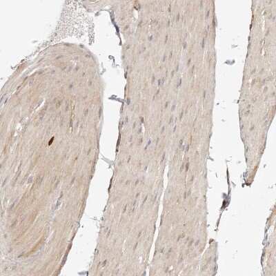 Immunohistochemistry-Paraffin: SYNC Antibody [NBP2-14497] - Staining of human smooth muscle shows cytoplasmic positivity in smooth muscle cells.