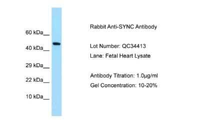 Western Blot: SYNC Antibody [NBP2-85857] - Host: Rabbit. Target Name: SYNC. Sample Type: Fetal Heart. Antibody Dilution: 1.0ug/ml