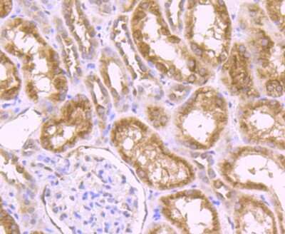 Immunohistochemistry-Paraffin: SYNE1 Antibody (JB35-26) [NBP2-75679] - Analysis of paraffin-embedded human kidney tissue using anti-Nesprin 1 antibody. Counter stained with hematoxylin.